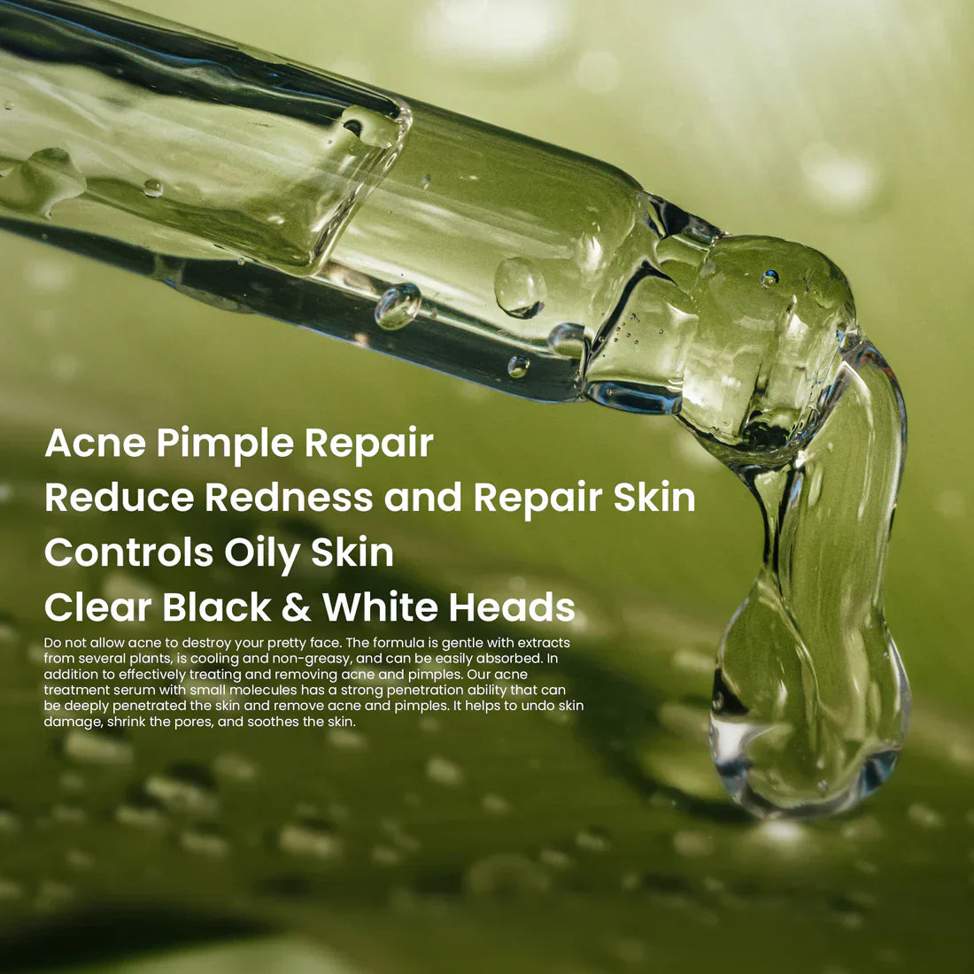 Rivaj Face Serum | Acne Treatment (30ml) | Best Price in Pakistan original skincare product Pakistan Main image