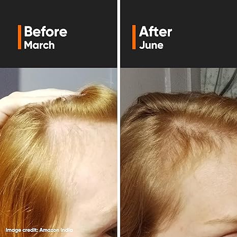 MINIMALIST HAIR GROWTH ACTIVES 18% - 30ML Secondary image