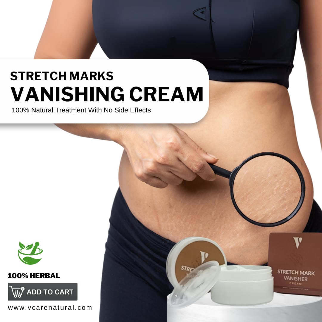 Stretch Mark Vanishing Cream | Best Price in Pakistan original skincare product Pakistan مرکزی تصویر